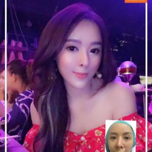 ฉีดไขมันหน้าเด็ก#18