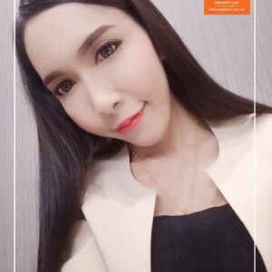 ฉีดไขมันหน้าเด็ก#19