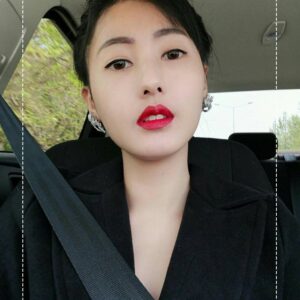 ฉีดไขมันหน้าเด็ก#23