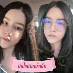 ฉีดไขมันหน้าเด็ก#3