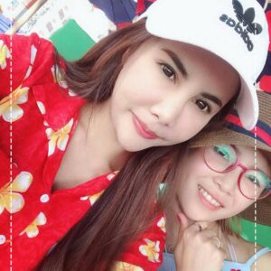 ฉีดไขมันหน้าเด็ก#32