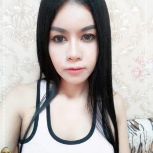 ฉีดไขมันหน้าเด็ก#33