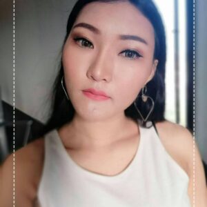 ฉีดไขมันหน้าเด็ก#34