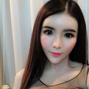 อาเซียนบิวตี้คลีนิค Asean Beauty Clinic รีวิวฉีดไขมันหน้าเด็ก#48