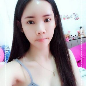 อาเซียนบิวตี้คลีนิค Asean Beauty Clinic รีวิวฉีดไขมันหน้าเด็ก#49