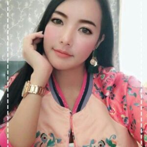 อาเซียนบิวตี้คลีนิค Asean Beauty Clinic รีวิวฉีดไขมันหน้าเด็ก#50