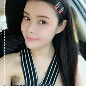 รีวิวฉีดไขมันหน้าเด็ก#58