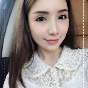 รีวิวฉีดไขมันหน้าเด็ก#64