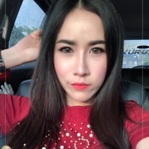 รีวิวฉีดไขมันหน้าเด็ก#66