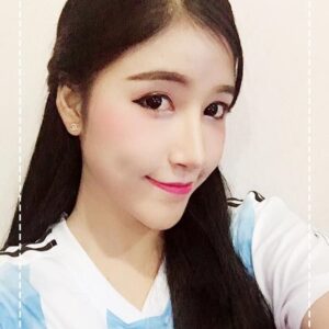 รีวิวฉีดไขมันหน้าเด็ก#67