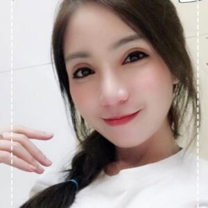 รีวิวฉีดไขมันหน้าเด็ก#70