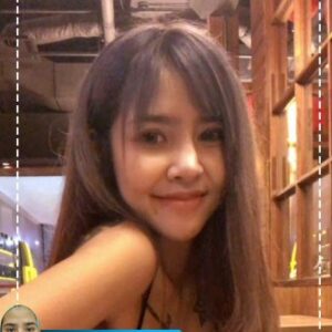 รีวิวฉีดไขมันหน้าเด็ก#71