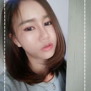 รีวิวฉีดไขมันหน้าเด็ก#73