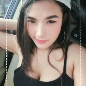 รีวิวฉีดไขมันหน้าเด็ก#76