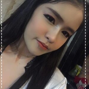 รีวิวฉีดไขมันหน้าเด็ก#77