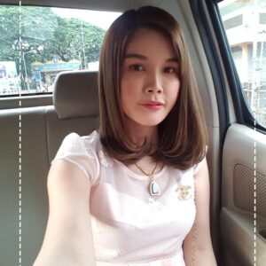 รีวิวฉีดไขมันหน้าเด็ก#78