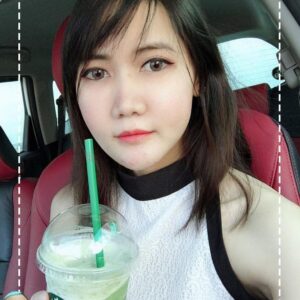 รีวิวฉีดไขมันหน้าเด็ก#79