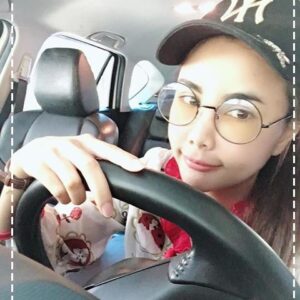 รีวิวฉีดไขมันหน้าเด็ก#80