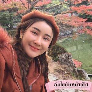 รีวิวฉีดไขมันหน้าเด็ก#81