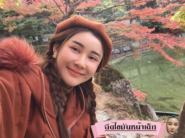 Review ฉีดไขมันหน้าเด็ก #81