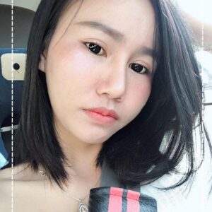 รีวิวฉีดไขมันหน้าเด็ก#82