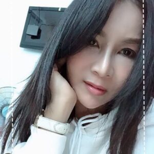 อาเซียนบิวตี้คลีนิค Asean Beauty Clinic รีวิวฉีดไขมันหน้าเด็ก#83