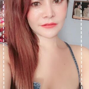 อาเซียนบิวตี้คลีนิค Asean Beauty Clinic รีวิวฉีดไขมันหน้าเด็ก#84