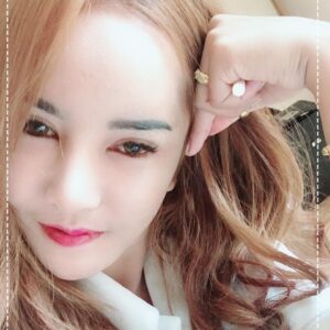 อาเซียนบิวตี้คลีนิค Asean Beauty Clinic รีวิวฉีดไขมันหน้าเด็ก#87