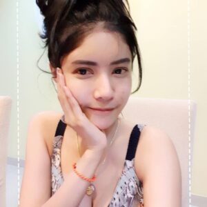 รีวิวฉีดไขมันหน้าเด็ก#88