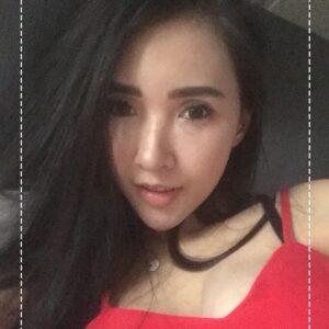 รีวิวฉีดไขมันหน้าเด็ก#90