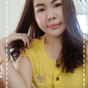 รีวิวฉีดไขมันหน้าเด็ก#91