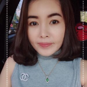 รีวิวฉีดไขมันหน้าเด็ก#92