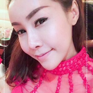 อาเซียนบิวตี้คลีนิค Asean Beauty Clinic รีวิวฉีดไขมันหน้าเด็ก#95