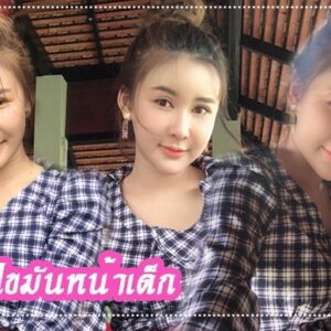อาเซียนบิวตี้คลีนิค Asean Beauty Clinic รีวิวฉีดไขมันหน้าเด็ก#97
