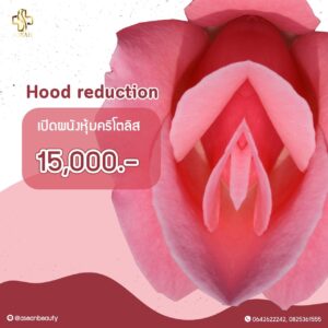 Promotion-HoodReduction