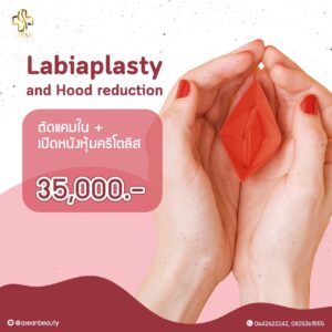 Promotion-LabiaplastyandHoodreduction