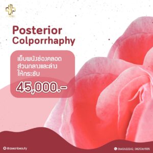 Promotion-PosteriorColporrhaphy
