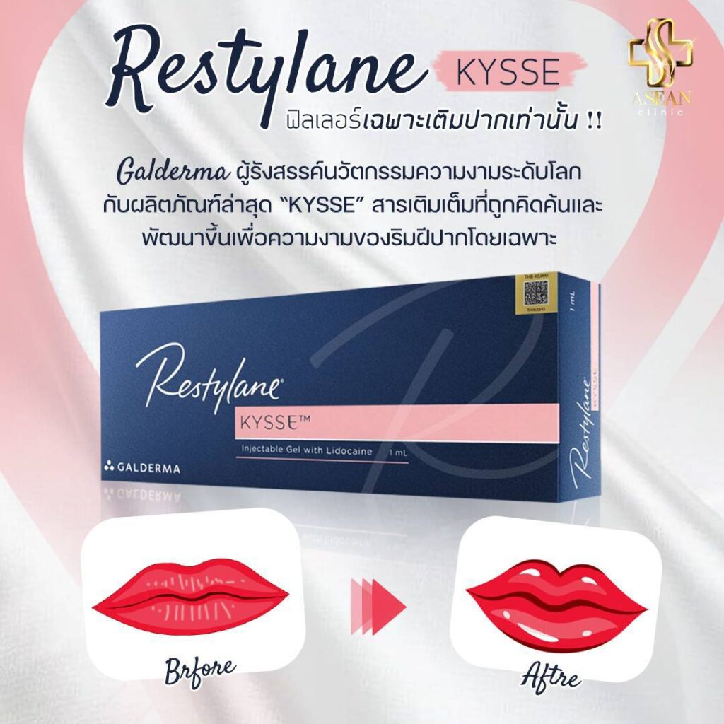 Restylane KYSSE3-AseanBeautyClinic