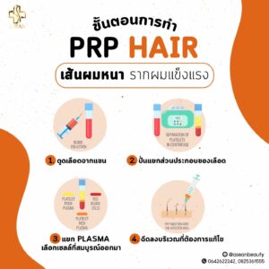 ขั้นตอนการทำ PRP HAIP-AseanBeautyClinic