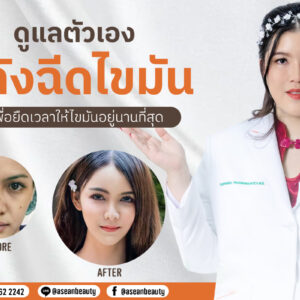 ดูแลตัวเองหลังฉีดไขมัน-AseanBeautyClinic