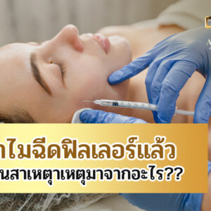 ทำไมฉีดฟิลเลอร์แล้วเป็นก้อนสาเหตุมาจากอะไร