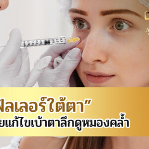 ฟิลเลอร์ใต้ตาช่วยแก้ไขเบ้าตาลึกดูหมองคล้ำ