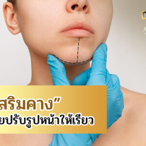 เสริมคางช่วยปรับรูปหน้าให้เรียว