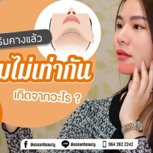 เสริมคางแล้ว บวมไม่เท่ากัน เกิดจากอะไร1-AseanBeautyClinic