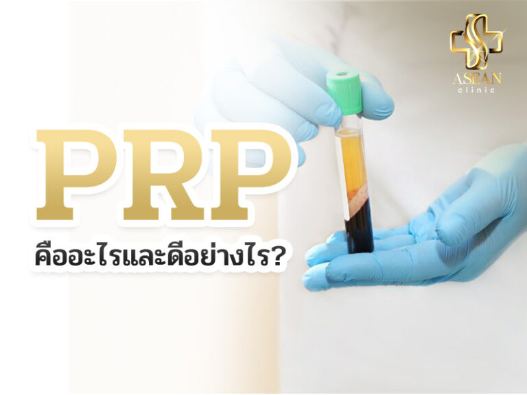 อาเซียนบิวตี้คลีนิค Asean Beauty Clinic PRP คืออะไรและดีอย่างไร?